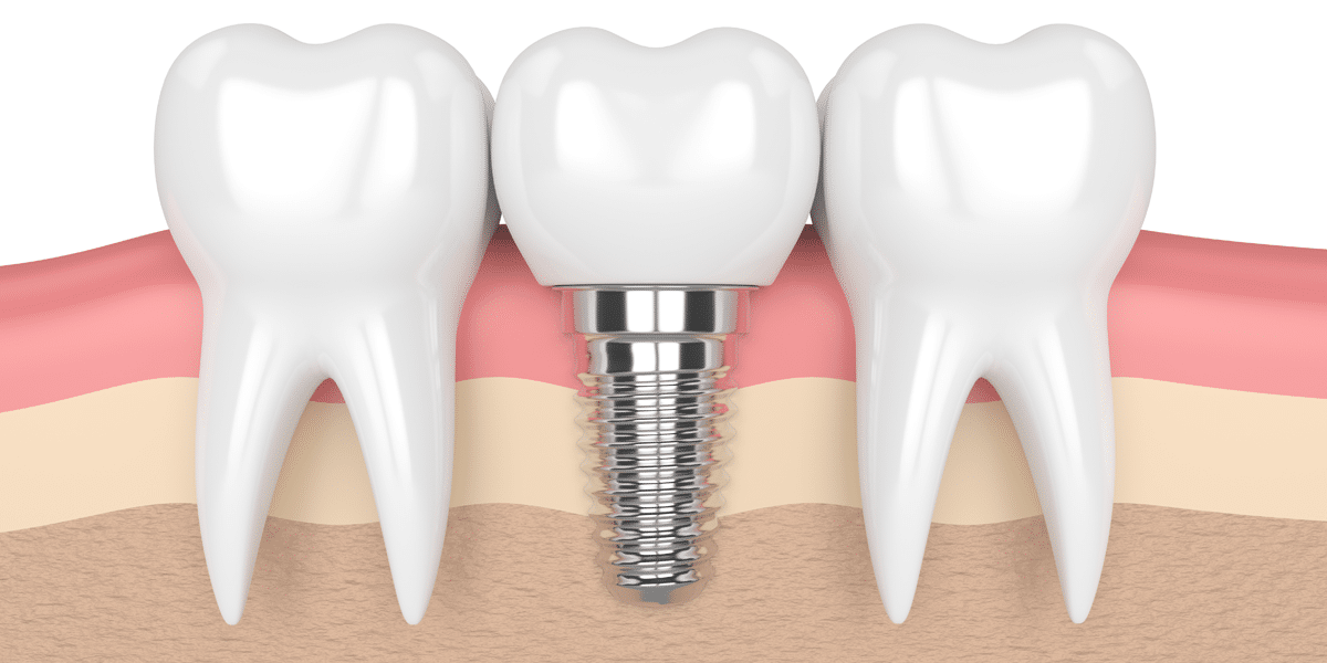 Dr Yolandi von Gericke